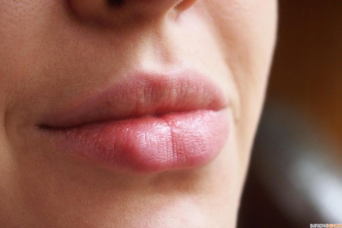 Какие губы считаются красивыми фото